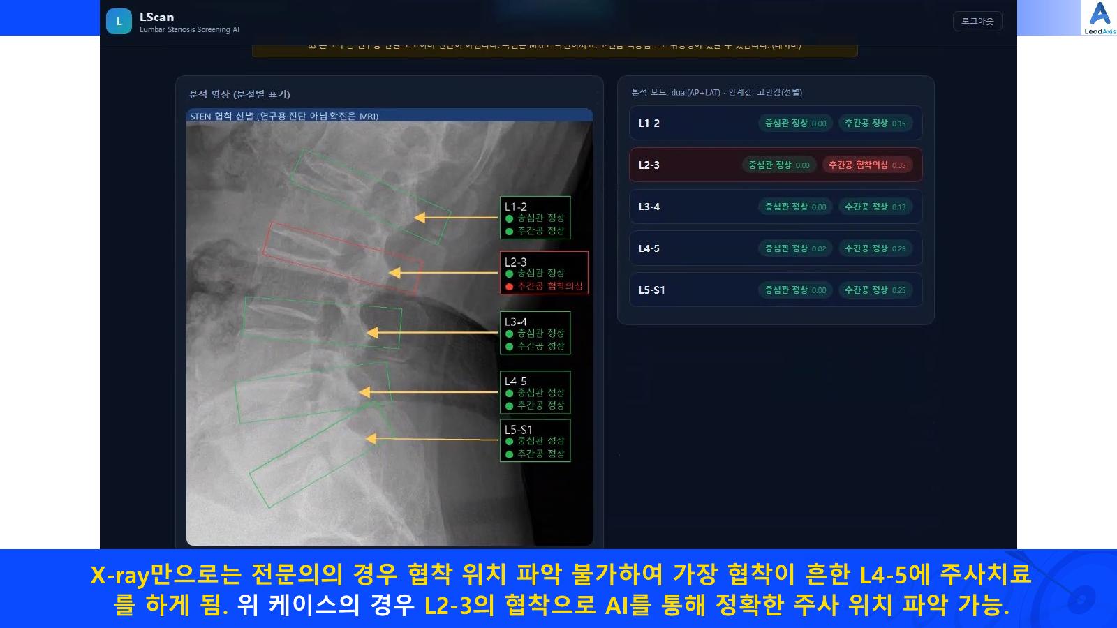 LeadAxis 소개자료 15