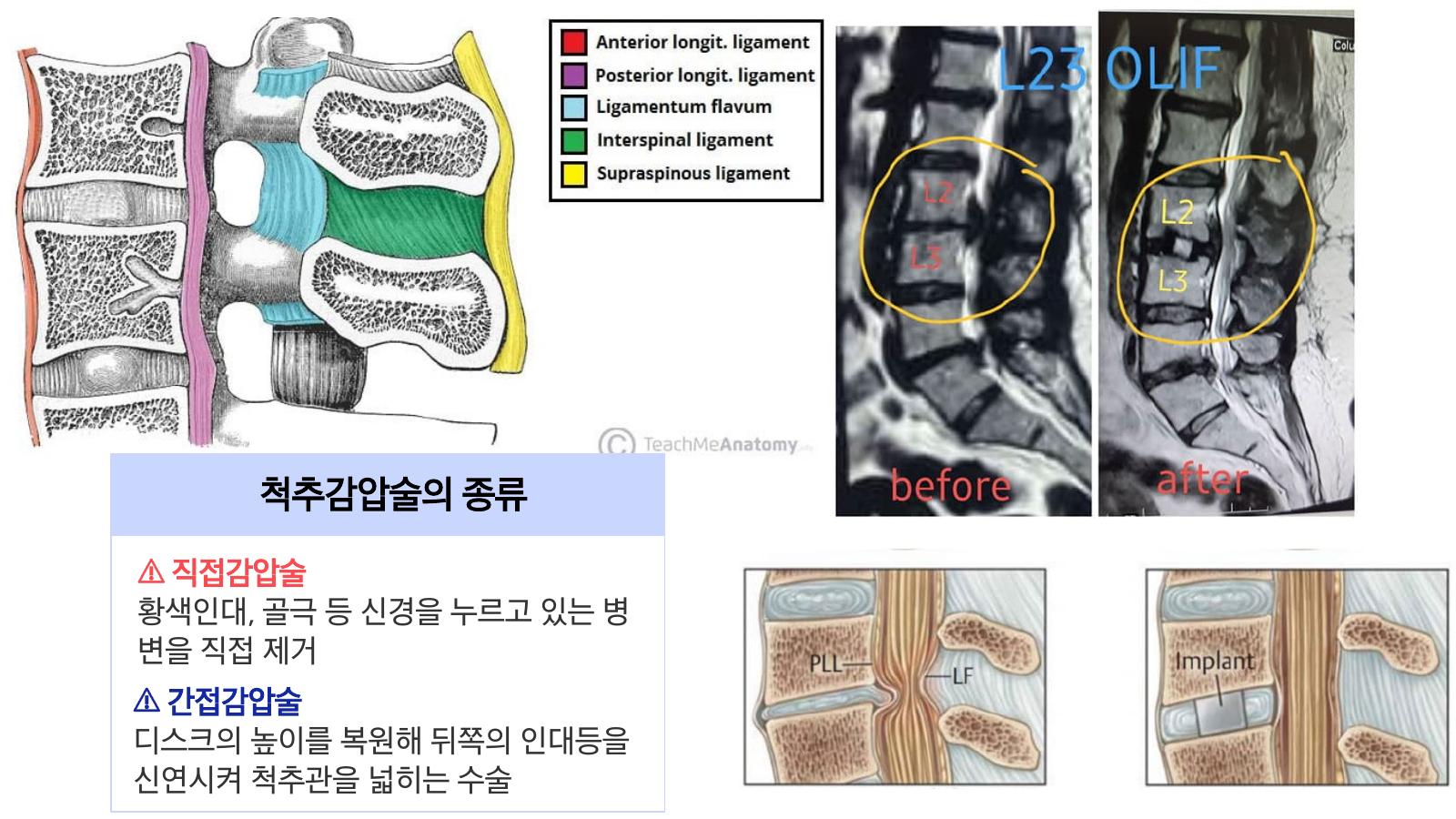 LeadAxis 소개자료 28