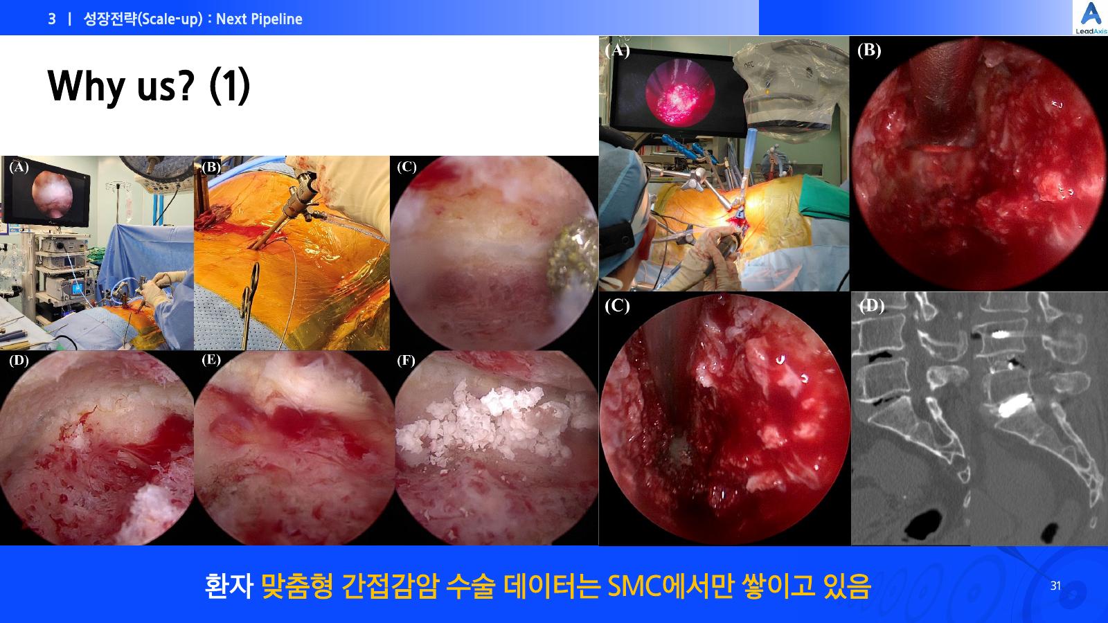 LeadAxis 소개자료 31